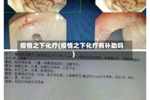 疫情之下化疗(疫情之下化疗有补助吗)