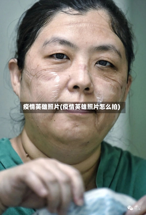 疫情英雄照片(疫情英雄照片怎么拍)-第1张图片